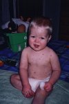 Chickenpox